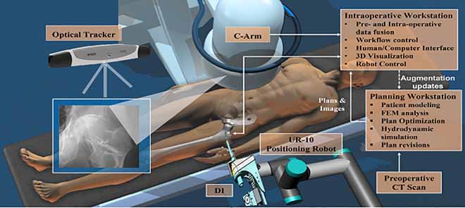 A Surgical Robotic System for Osteoporotic Hip Augmentation: System Development and Experimental Evaluation