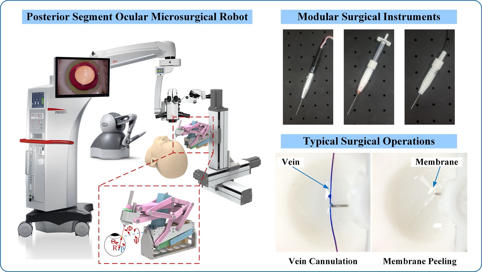 Optik Rscm A Posterior Segment Ocular Microsurgical Robot with a Decoupling RCM ...